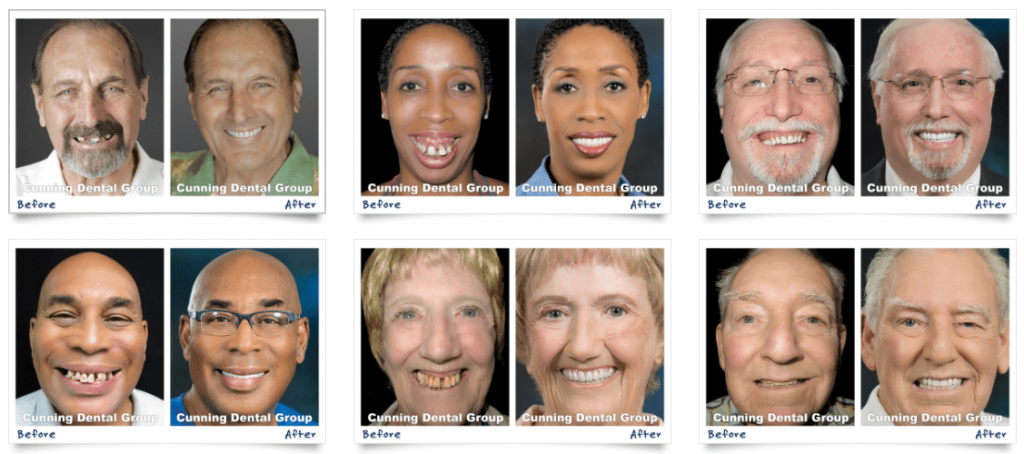 Cunning Dental Group Before & Afters